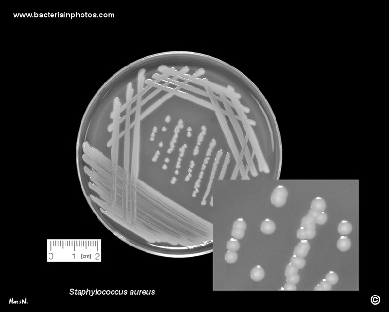 MRSA-bacterie